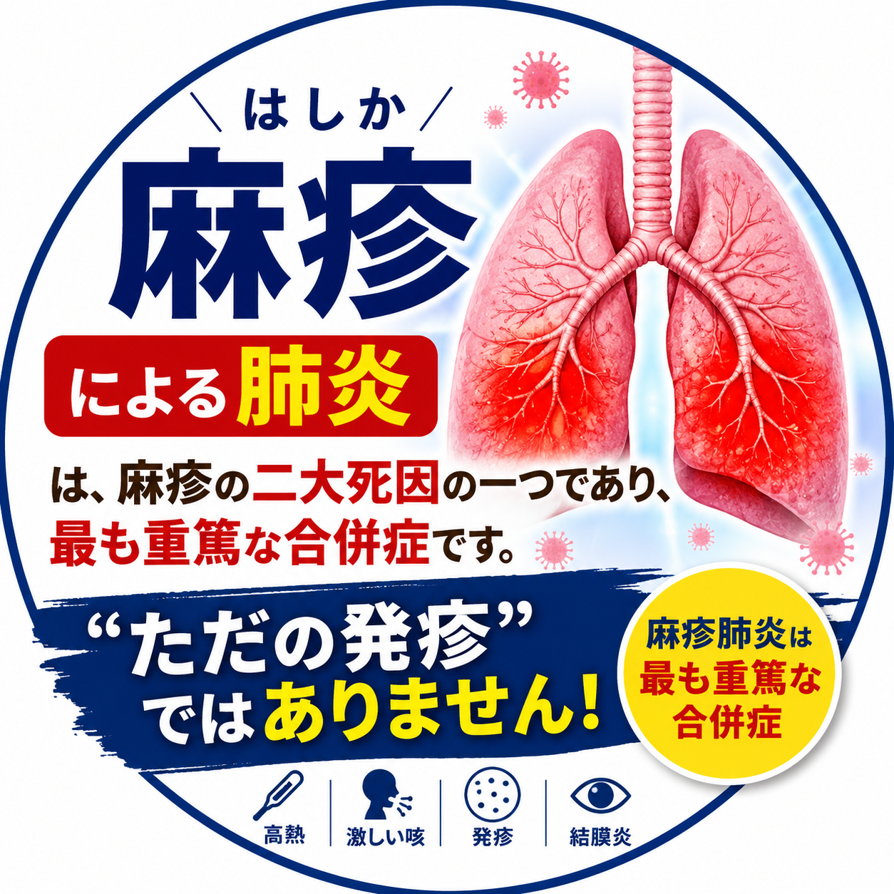 麻疹（はしか）による肺炎は、麻疹の二大死因